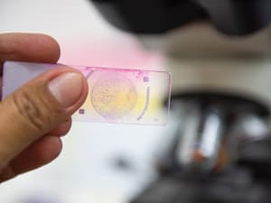 苯扎贝特片药理机制：如何降低胆固醇？