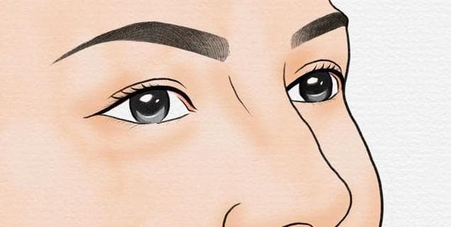 青少年视物模糊、出现重影，得防治散光加深，3条科学手段要用好