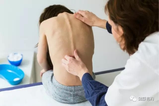 孩子越长越歪？五张手绘教你及早发现脊柱侧弯