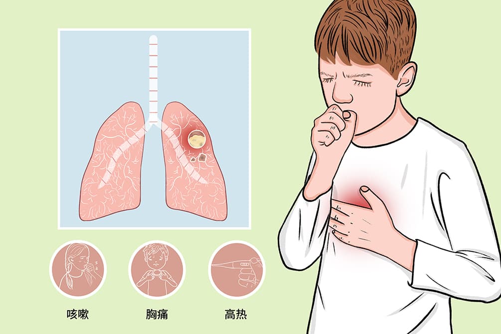 肺痈是什么意思