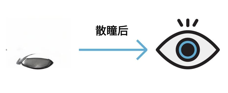 什么是散瞳验光？散瞳后注意事项