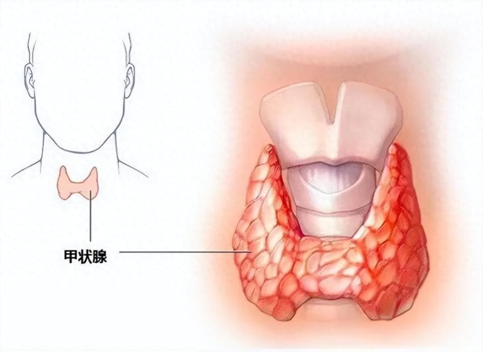 吕鹏飞团队引领甲状腺手术新潮流：从“颈部无痕”到“微创消融”