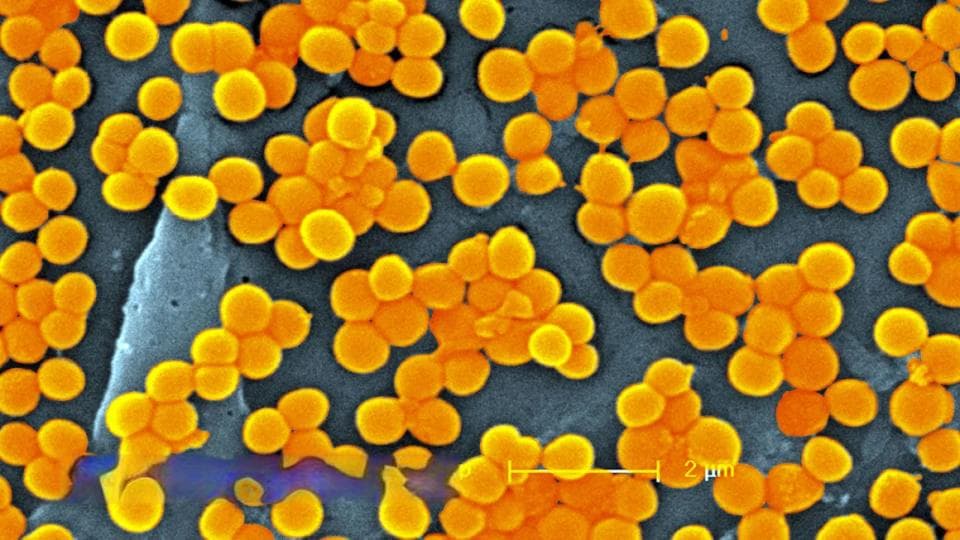 新研究：到2050年，近4000万人可能死于抗生素耐药性超级细菌感染