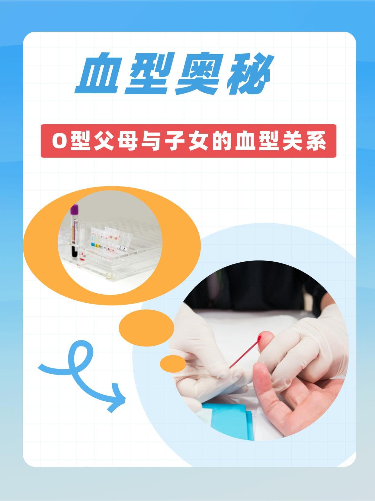 血型奥秘：O型父母与子女的血型关系