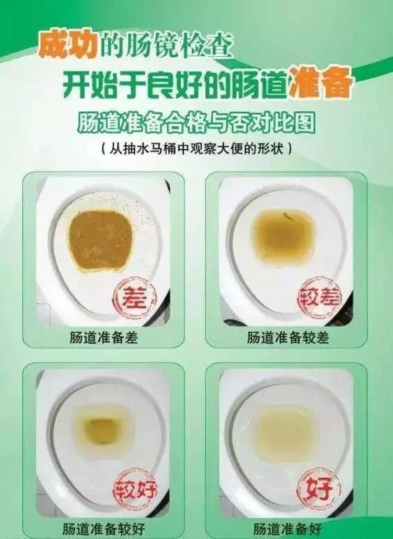消化内镜检查超全讲解：胃镜、结肠镜、小肠镜、超声内镜、无痛内镜、胶囊内镜