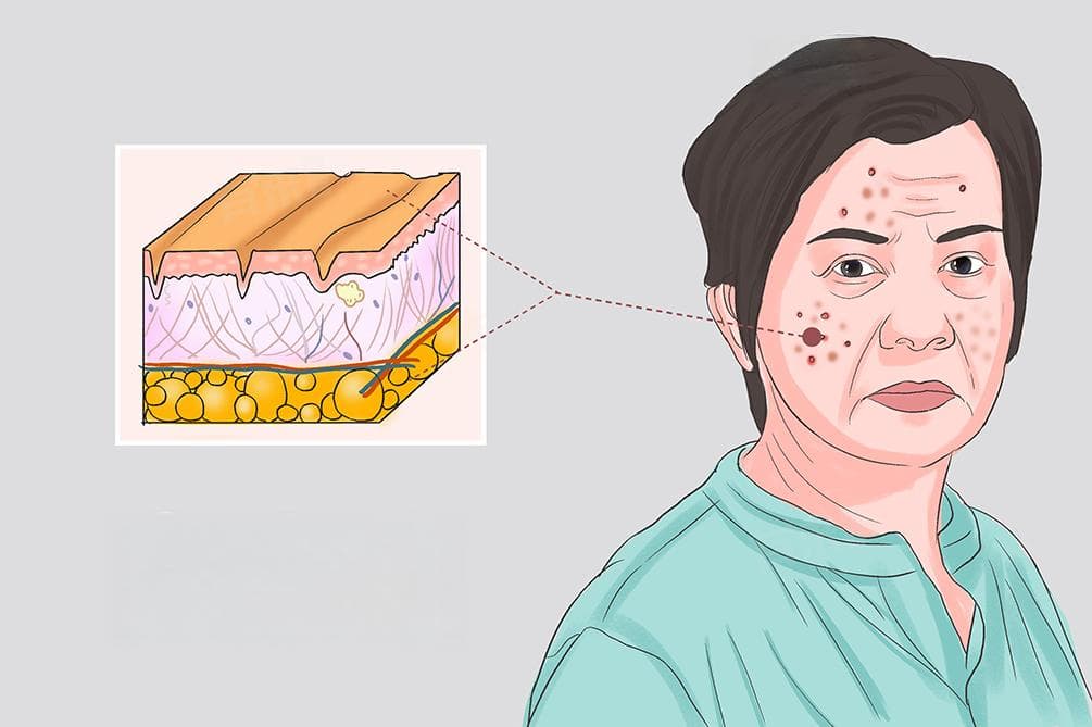女人多大开始衰老