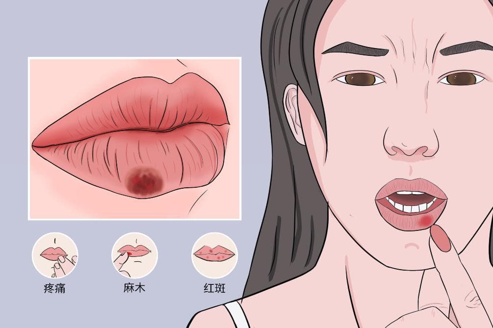 唇炎是缺什么维生素造成的