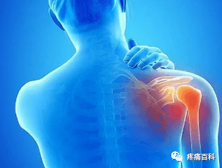 肩关节腔注射玻璃酸钠联合痛点阻滞治疗肩周炎