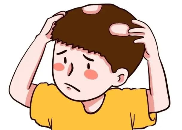 步入夏季还脱发？你是不是做了这些事？