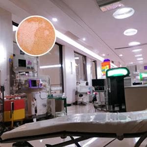 泼尼松主要副作用及应对方法