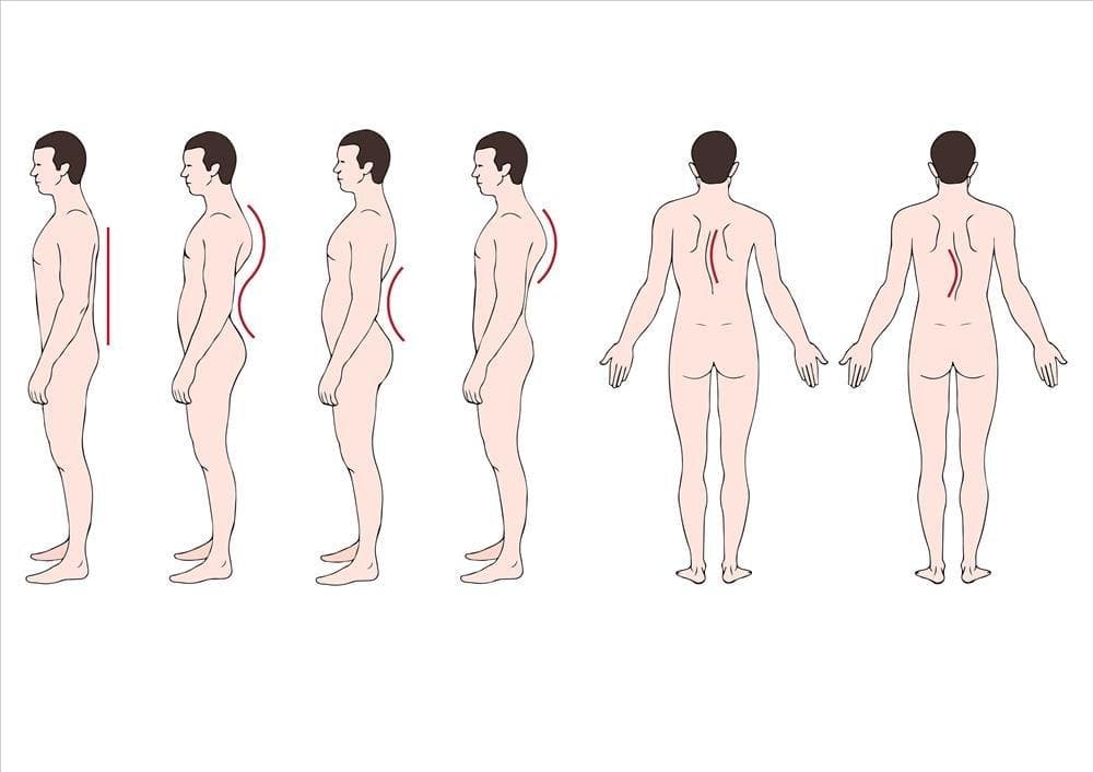 腰椎间盘突出和腰肌劳损有什么区别