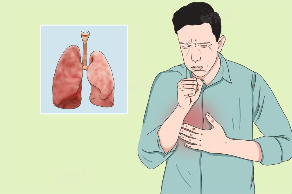 肺气肿有治疗的方法吗
