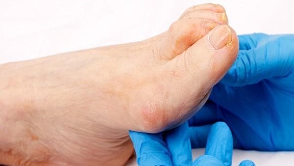 糖尿病能喝酸奶吗？糖尿病患者需喝无糖或低糖酸奶