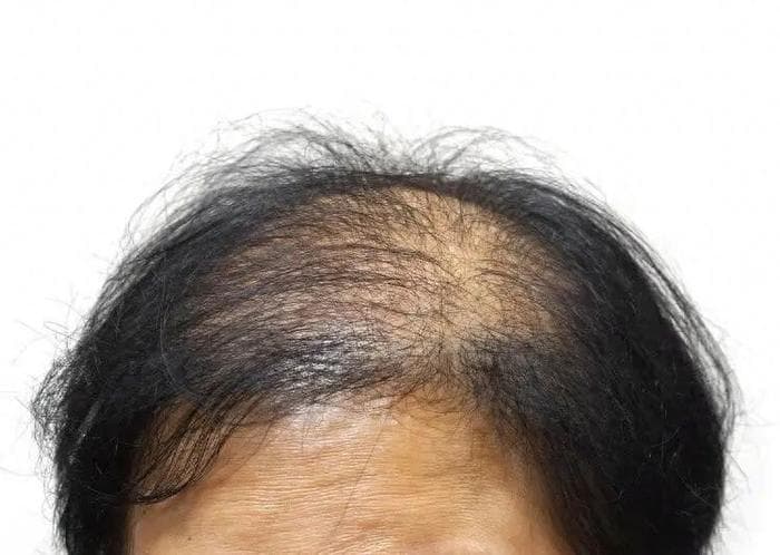 “眉毛一根长，胜过万担粮”有何讲究？眉毛变长通常意味着什么？