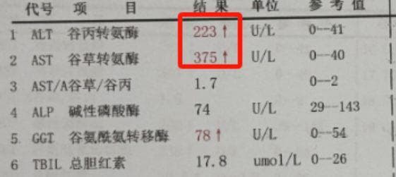 肝脏警报！转氨酶升高分三级，你处于哪个阶段？