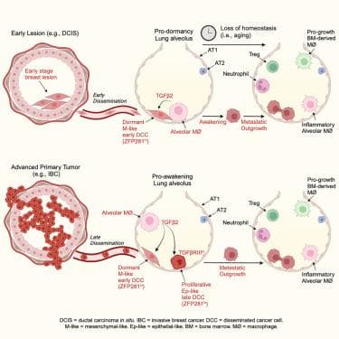 Cell：新研究发现肺泡巨噬细胞阻止转移性癌症形成机制