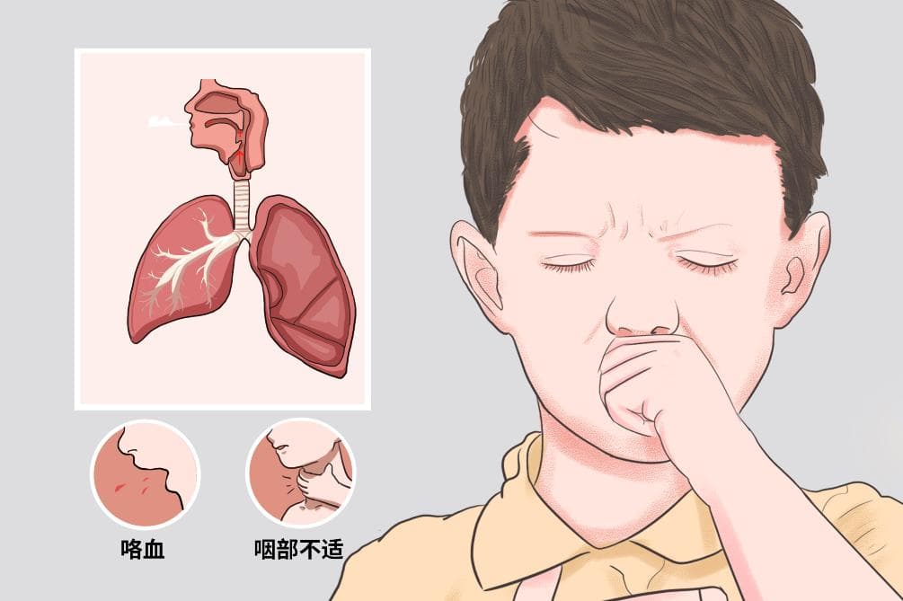 小孩不停咳嗽怎么办？5个实用缓解方法