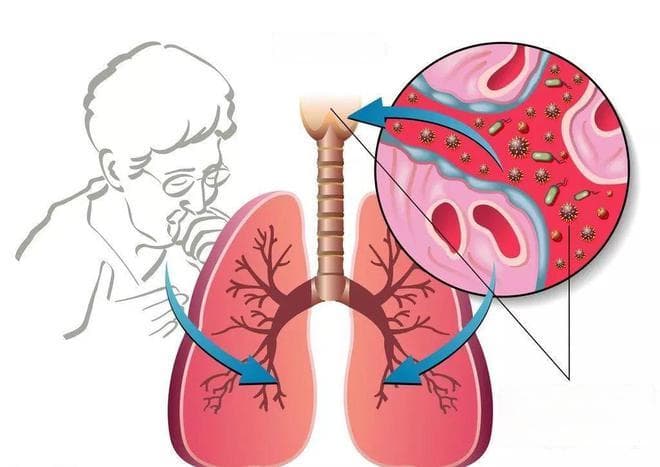 药师笔记|10种常见易引起干咳的药物，你都知道吗？