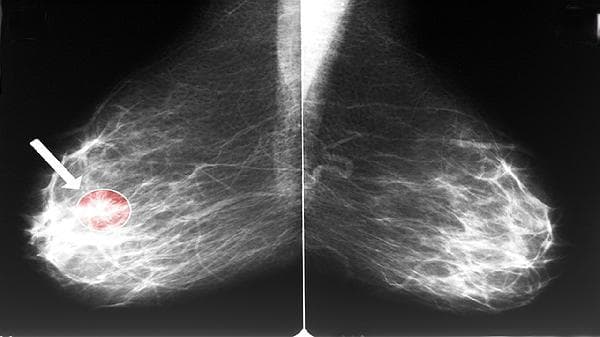 细胞免疫和体液免疫：人体免疫系统的双重防线
