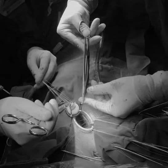 因害怕手术，严重心脏病男子一忍就是13年！终于“补心”成功