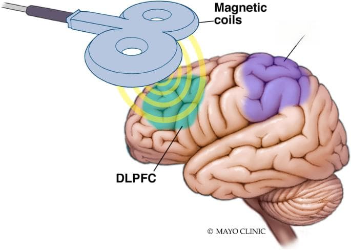 失眠治疗新视角：控制刺激法与替代疗法的有效性