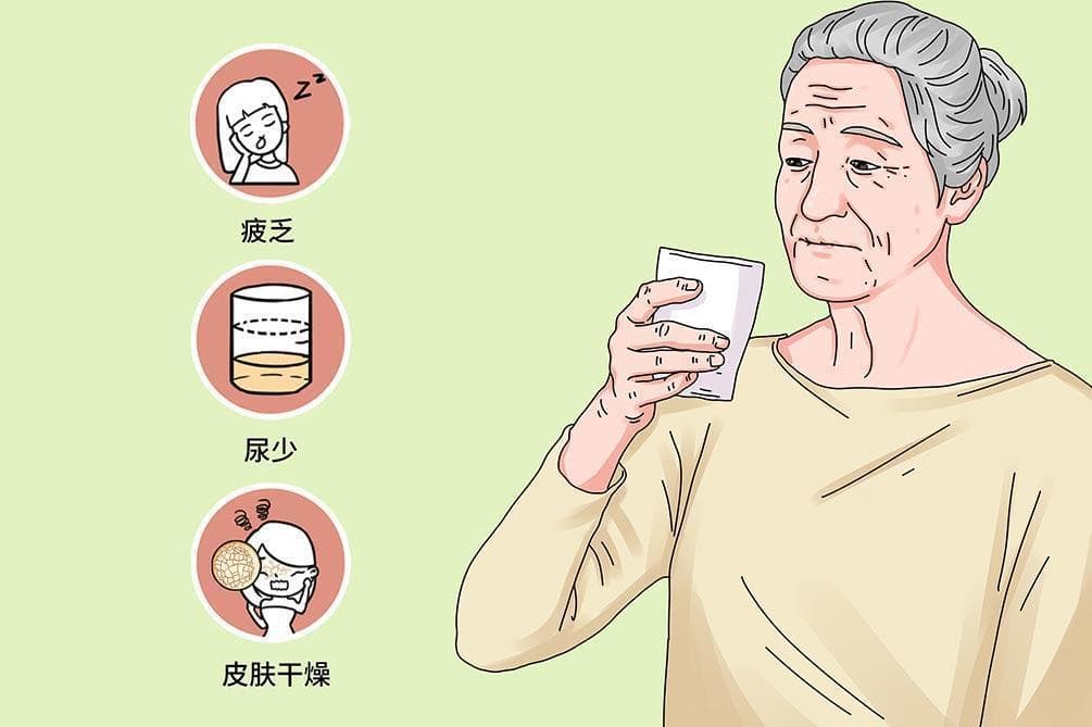 口腔干燥症最好的治疗方法