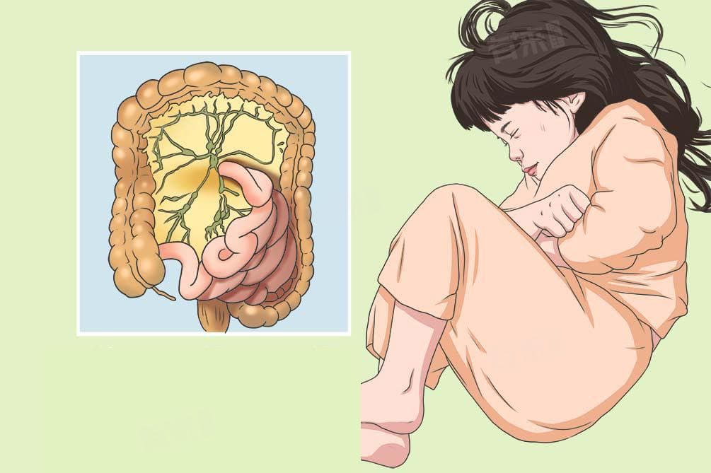 肠系膜淋巴结炎怎么治疗