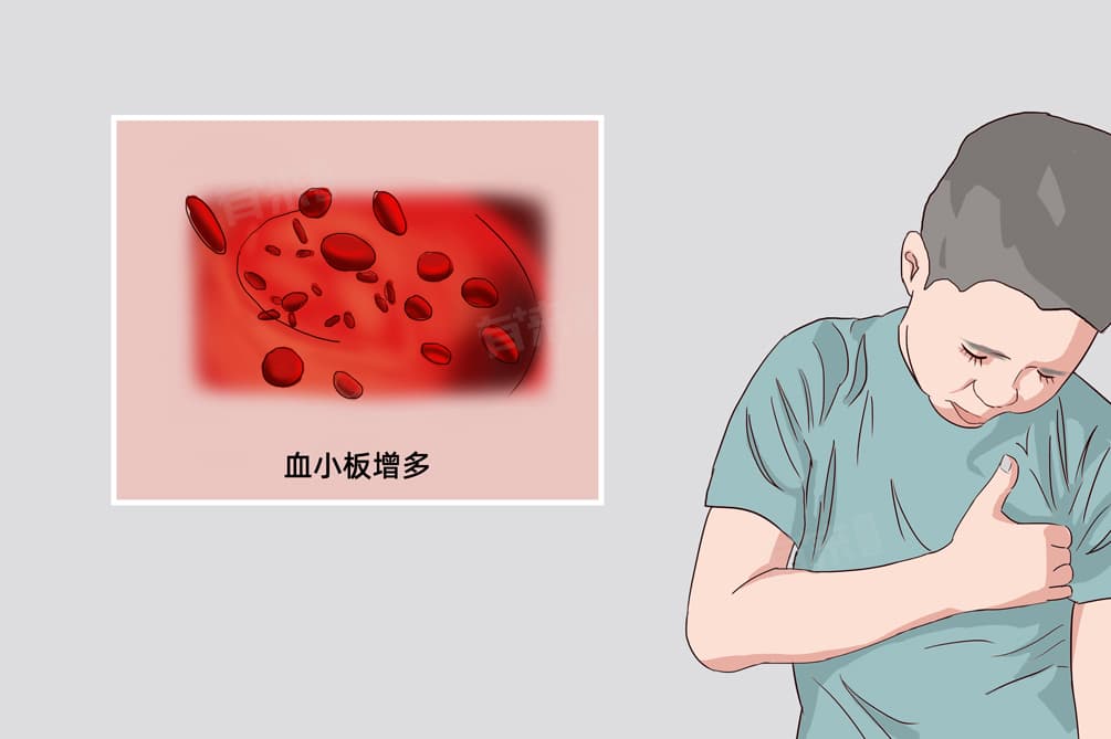 血小板增多病因及预防措施