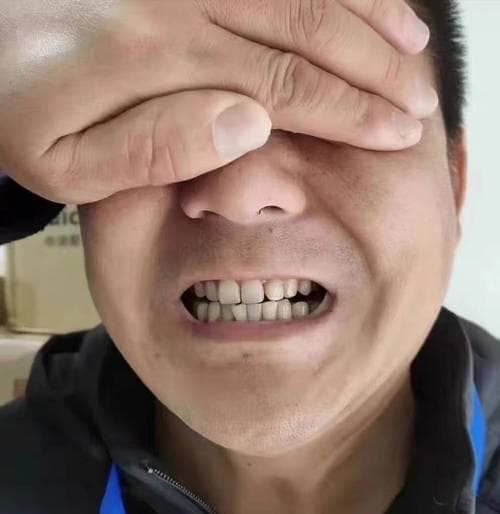 牙有烟渍怎么办？全面指南助你恢复洁白牙齿