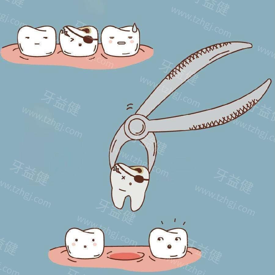 拔牙过程详解：如何选择适合的麻醉方式？