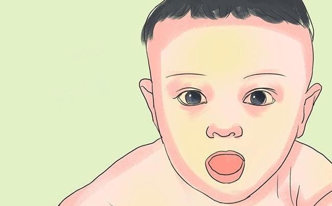 新生儿黄疸是怎么产生的