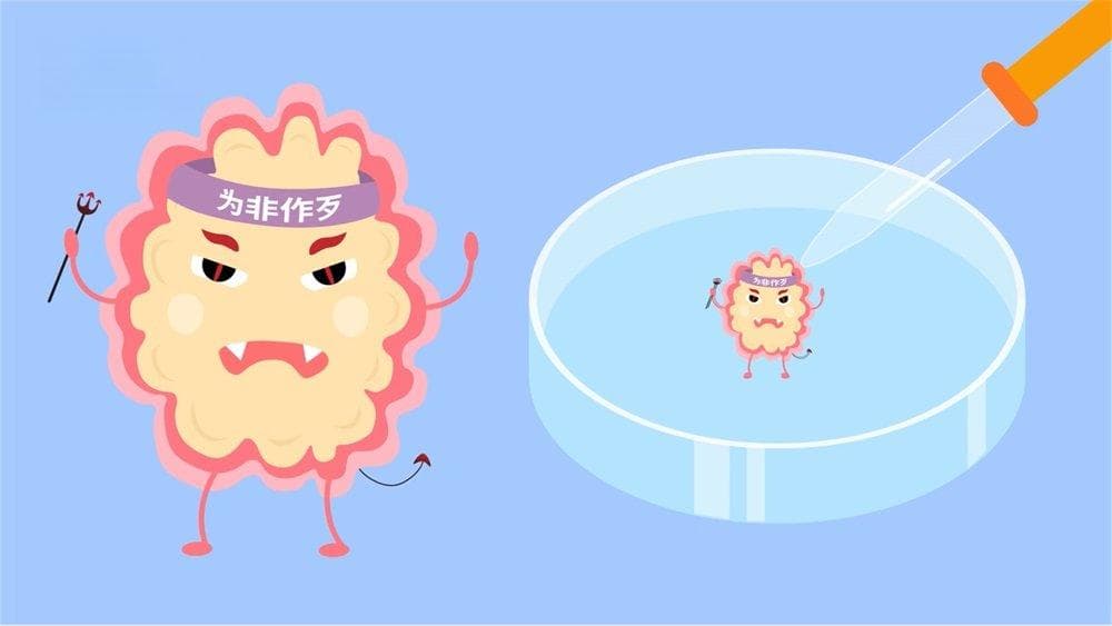 丘脑胶质母细胞瘤：从病因到护理的全面解析