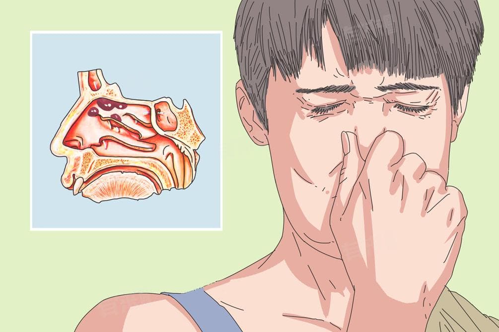 嗅觉失灵怎么办？八大方法助你快速恢复