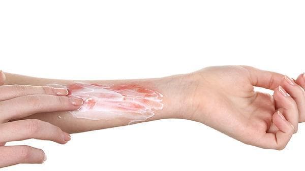 抬重物手臂肌肉拉伤怎么办