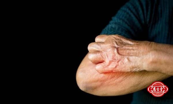 皮肤瘙痒中医辩证：全面解读中医视角下的皮肤瘙痒现象