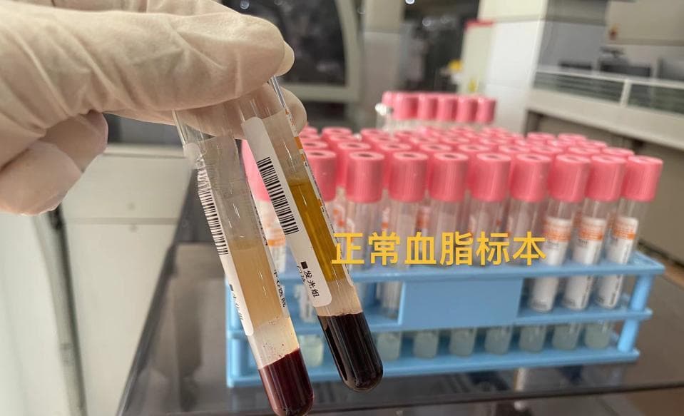 血管里的脂肪陷阱如何影响你的健康？