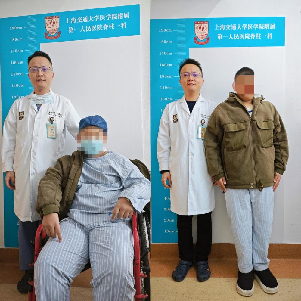 少年患先天性脊柱畸形，机器人协助医生为其重启“直立人生”