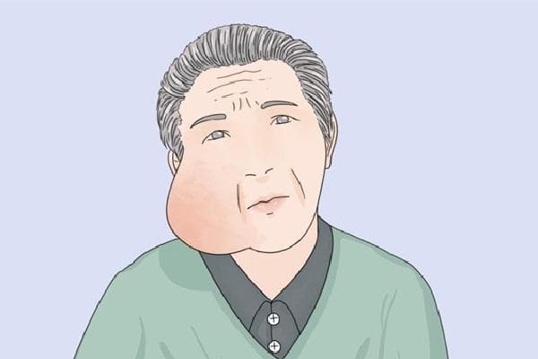 重庆治疗肿瘤最好的医院 重庆治疗肿瘤的专业医院