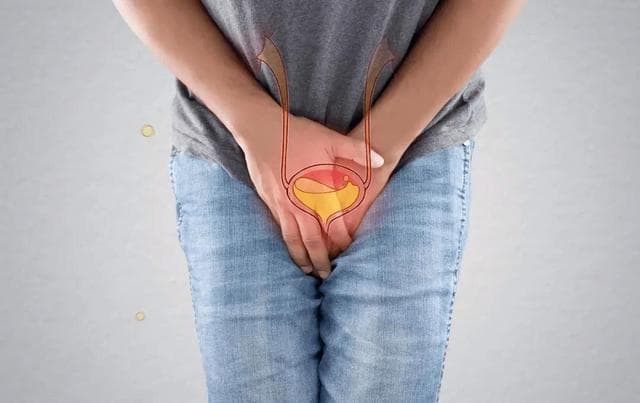 一有尿意就去上？错了！医生建议这样排尿膀胱更健康！