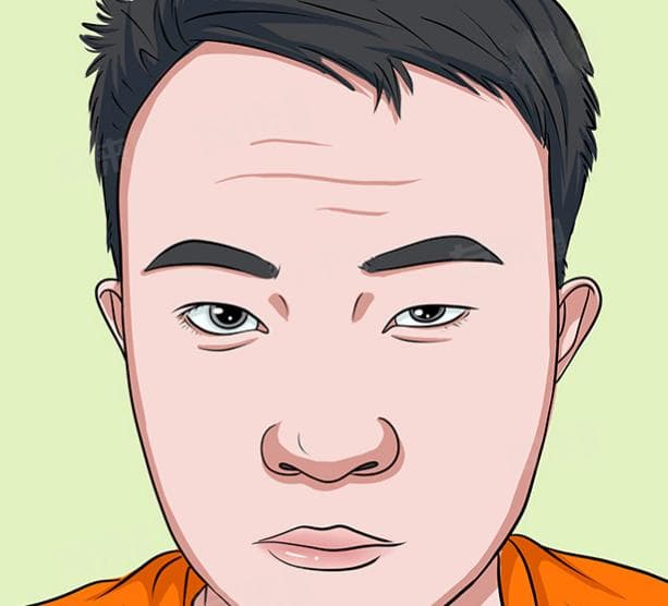 大小眼最好的矫正方法