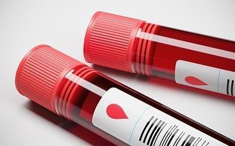验血 IgE 升高就是过敏体质吗？医生：看这2点，帮你正确解读