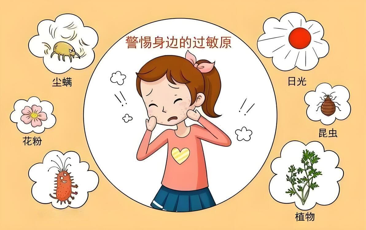 荨麻疹的多元成因与预防治疗策略