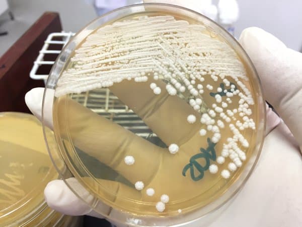 白色念珠菌感染怎么治用什么药肺部