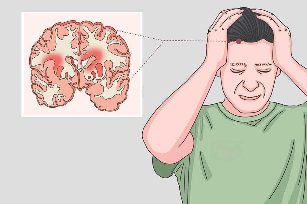 白塞病治疗方案