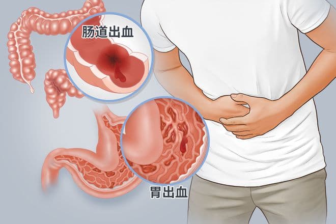 北京大学第一医院研究发现：60岁后服用阿司匹林，小剂量更安全