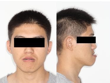 正颌手术在口腔领域中是一种怎样的存在？