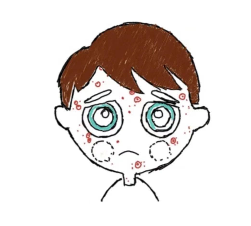 【健康大讲堂】战痘到底