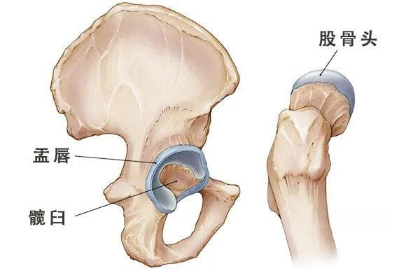 髋关节盂唇撕裂的原因及其疼痛的缓解运动