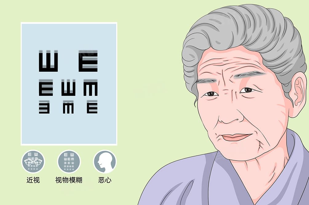 眼睛看东西模糊重影是怎么回事