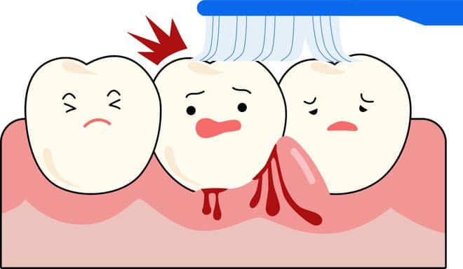 牙龈肿痛出血怎么办？教你7个有效的预防方法！守护口腔健康